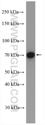 PKC Pan Antibody in Western Blot (WB)