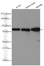 PKC Pan Antibody in Western Blot (WB)