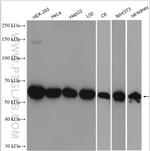 HDAC2 Antibody in Western Blot (WB)