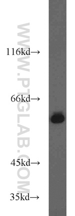 HDAC2 Antibody in Western Blot (WB)