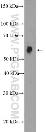 HDAC2 Antibody in Western Blot (WB)
