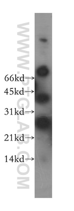 NME5 Antibody in Western Blot (WB)