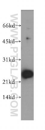 NME5 Antibody in Western Blot (WB)