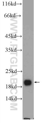 NCALD Antibody in Western Blot (WB)