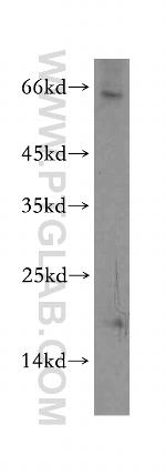 TXNL4B Antibody in Western Blot (WB)