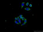 IRF6 Antibody in Immunocytochemistry (ICC/IF)