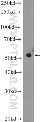 IRF6 Antibody in Western Blot (WB)