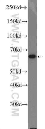 IRF6 Antibody in Western Blot (WB)