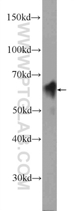 IRF6 Antibody in Western Blot (WB)