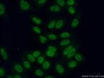 ASF/SF2 Antibody in Immunocytochemistry (ICC/IF)