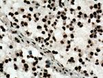 ASF/SF2 Antibody in Immunohistochemistry (Paraffin) (IHC (P))