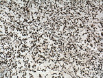 ASF/SF2 Antibody in Immunohistochemistry (Paraffin) (IHC (P))