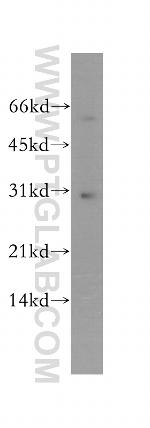 YIPF5 Antibody in Western Blot (WB)