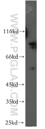 MARK3 Antibody in Western Blot (WB)