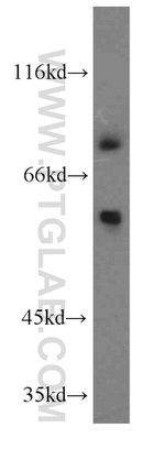 MARK3 Antibody in Western Blot (WB)