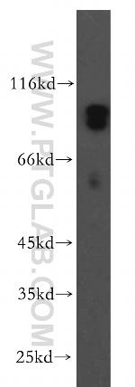 MARK3 Antibody in Western Blot (WB)