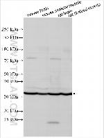 KCNMB1 Antibody in Western Blot (WB)