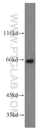 NFE2L1 Antibody in Western Blot (WB)