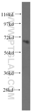 NFE2L1 Antibody in Western Blot (WB)
