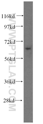 NFE2L1 Antibody in Western Blot (WB)