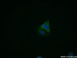 PSME2 Antibody in Immunocytochemistry (ICC/IF)