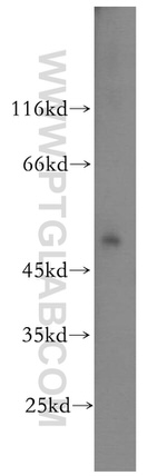 IFRD1 Antibody in Western Blot (WB)