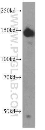 CLASP2 Antibody in Western Blot (WB)