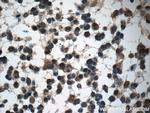 GAGE7 Antibody in Immunohistochemistry (Paraffin) (IHC (P))