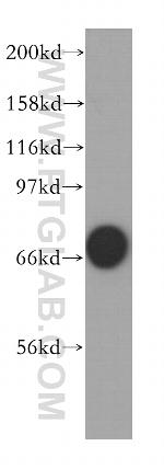 VRK2 Antibody in Western Blot (WB)