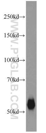 TMPRSS6 Antibody in Western Blot (WB)