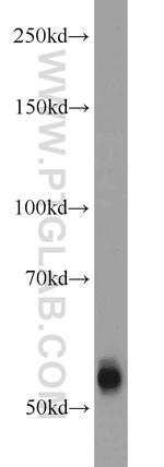 TMPRSS6 Antibody in Western Blot (WB)