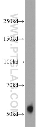TMPRSS6 Antibody in Western Blot (WB)