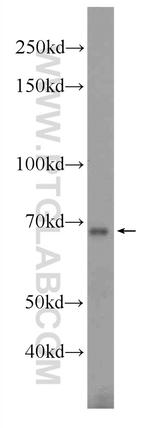 TRIM69 Antibody in Western Blot (WB)
