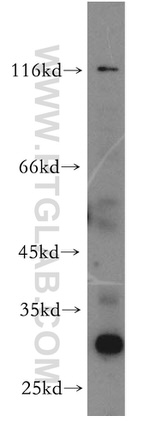 TRIM69 Antibody in Western Blot (WB)