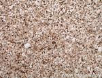 CA10 Antibody in Immunohistochemistry (Paraffin) (IHC (P))