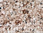 CA10 Antibody in Immunohistochemistry (Paraffin) (IHC (P))