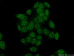 FANCM Antibody in Immunocytochemistry (ICC/IF)