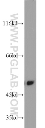 ILK Antibody in Western Blot (WB)