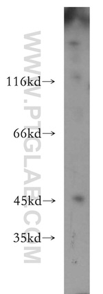 LIPA Antibody in Western Blot (WB)