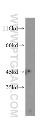 LIPA Antibody in Western Blot (WB)