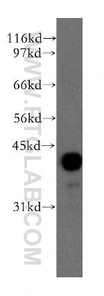 PPM1A Antibody in Western Blot (WB)