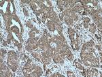 PPM1A Antibody in Immunohistochemistry (Paraffin) (IHC (P))