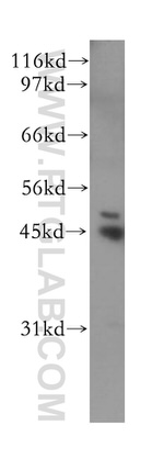 PPM1A Antibody in Western Blot (WB)