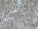 EBP Antibody in Immunohistochemistry (Paraffin) (IHC (P))