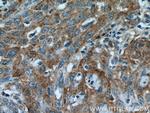 EBP Antibody in Immunohistochemistry (Paraffin) (IHC (P))