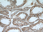 CPT1C Antibody in Immunohistochemistry (Paraffin) (IHC (P))