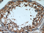 CPT1C Antibody in Immunohistochemistry (Paraffin) (IHC (P))