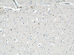 CPT1C Antibody in Immunohistochemistry (Paraffin) (IHC (P))