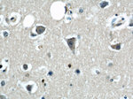 CPT1C Antibody in Immunohistochemistry (Paraffin) (IHC (P))