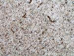 CPT1C Antibody in Immunohistochemistry (Paraffin) (IHC (P))